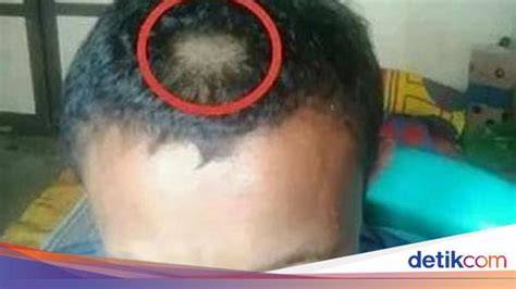 FuLl ViDeO GuRu GoRoNtAlO hadirkan aksesori rambut Bumper baja kuat terbaru image 1